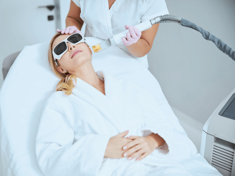 Trị nám bằng Laser Pico - 5