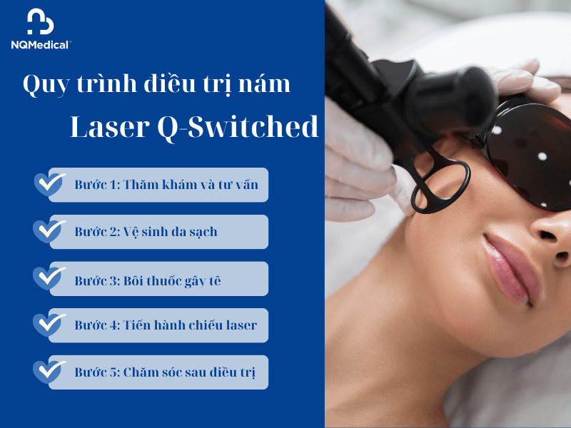 Điều Trị Nám Laser Q Switched -4