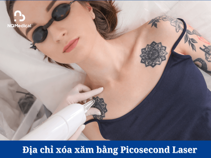 Xóa xăm bằng Laser Picosecond - 8