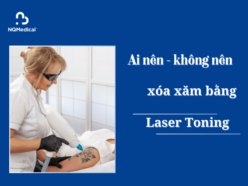 xóa xăm bằng laser toning -3
