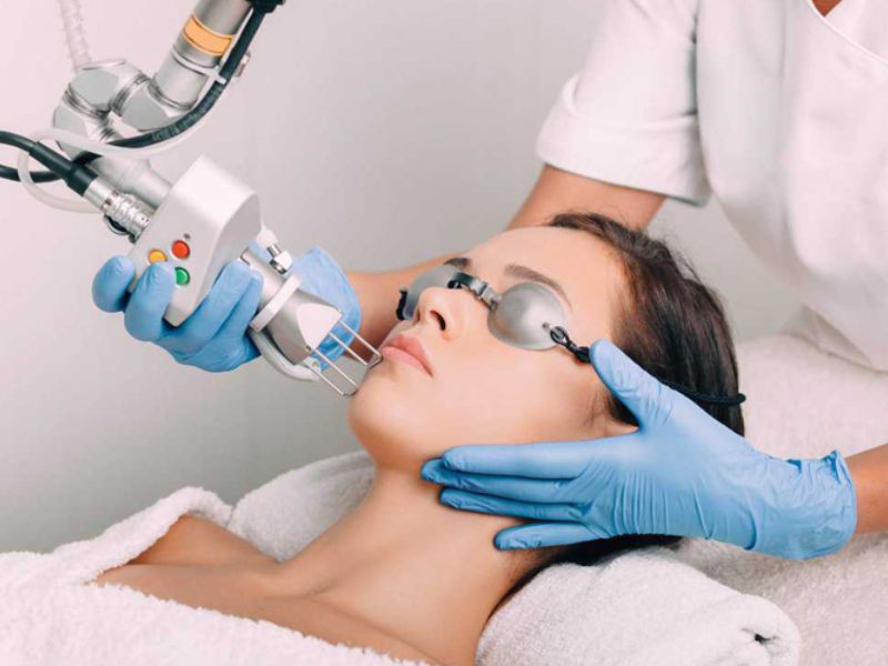 Điều trị mụn trứng cá bằng laser - 5