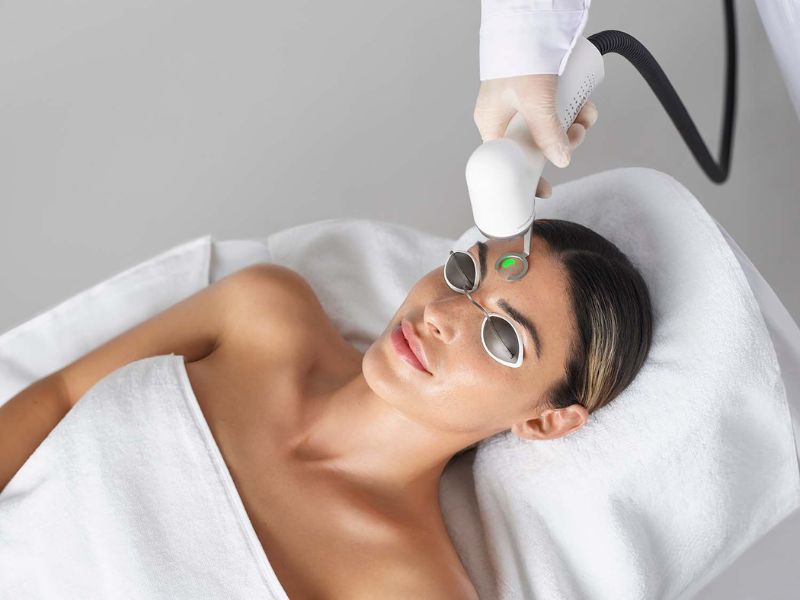 Điều trị mụn trứng cá bằng laser - 6