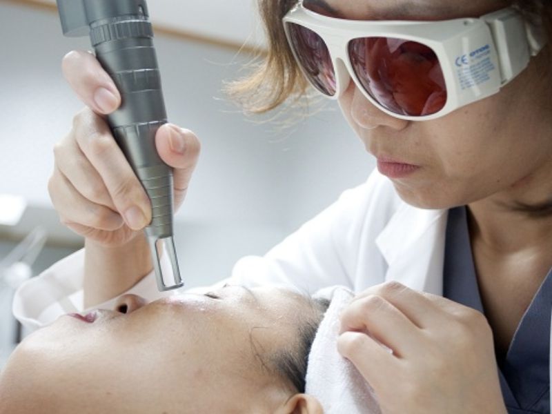 Đốt laser mụn cóc bao lâu thì lành - 6