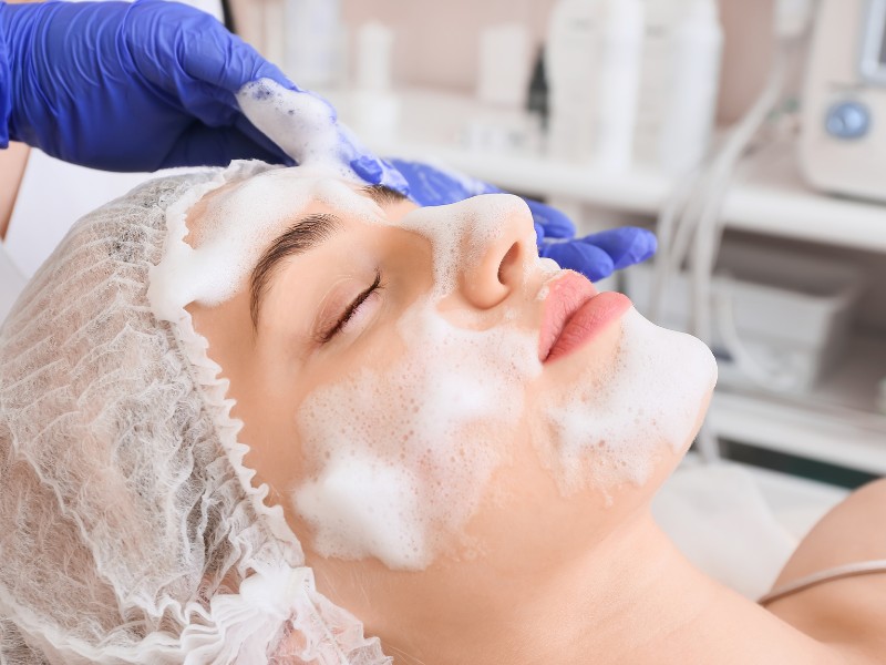 Quy trình điều trị nám bằng Laser -5