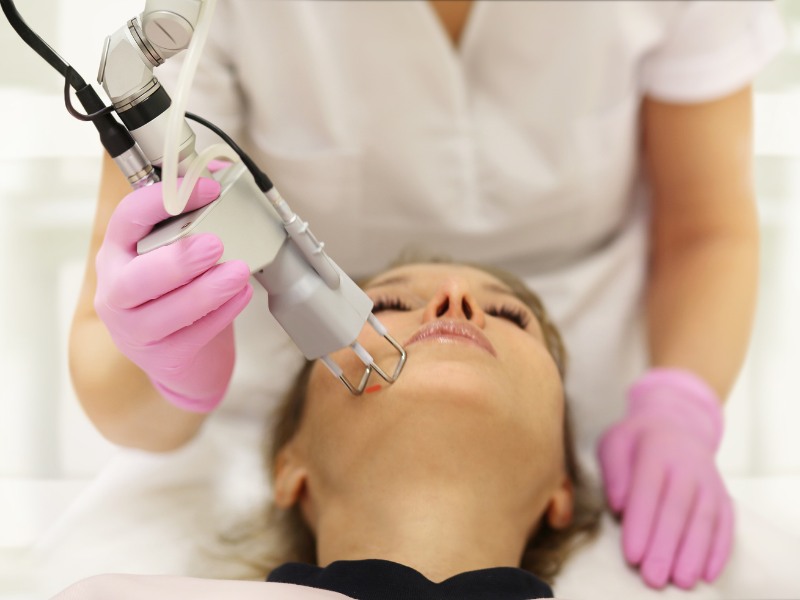 Quy trình điều trị nám bằng Laser -6