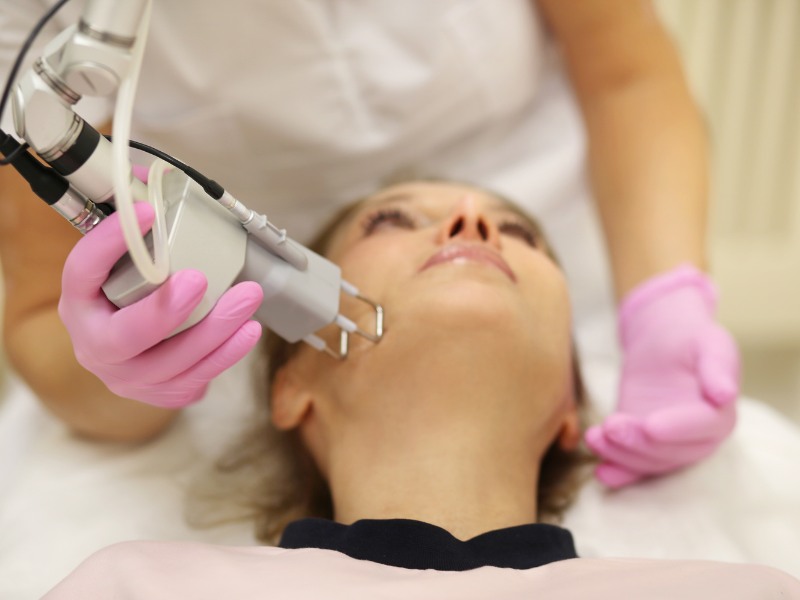 Review trị nám bằng laser -2