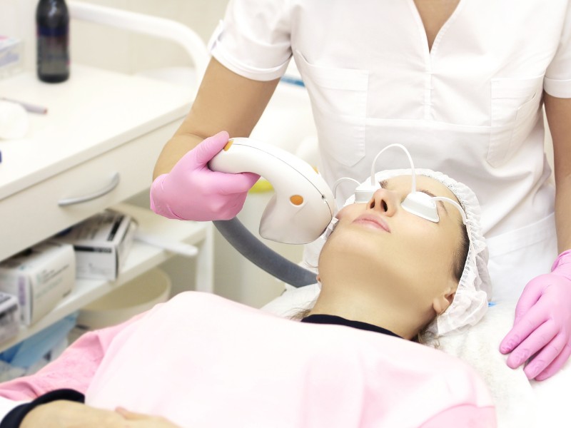 Review trị nám bằng laser -3