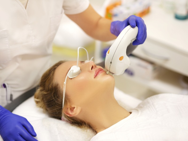 Review trị nám bằng laser -5