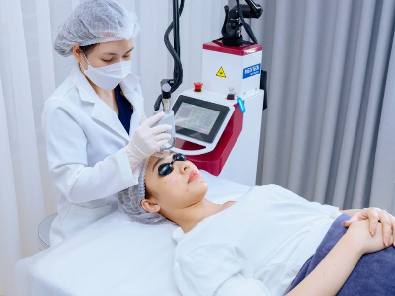 Trị mụn ẩn bằng laser - 10