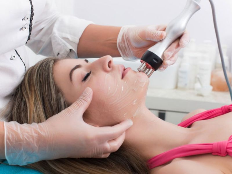 Trị mụn ẩn bằng laser - 7