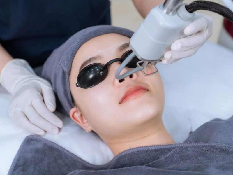 Trị mụn bằng laser giá bao nhiêu - 2