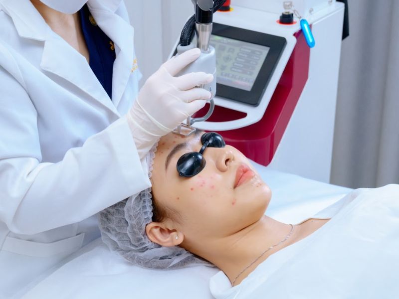 Trị mụn bằng laser giá bao nhiêu - 6