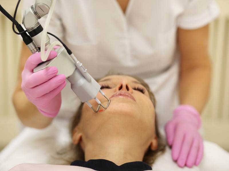 Trị nám bằng laser bao nhiêu tiền - 4