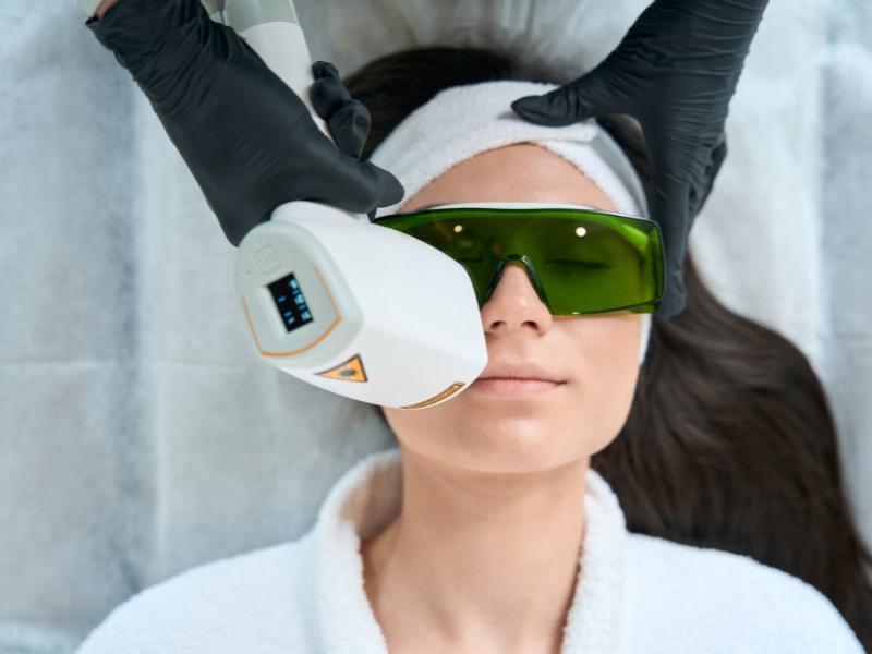 Trị nám bằng laser bao nhiêu tiền - 6