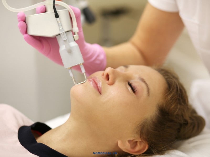 Trị sẹo bằng laser - 5