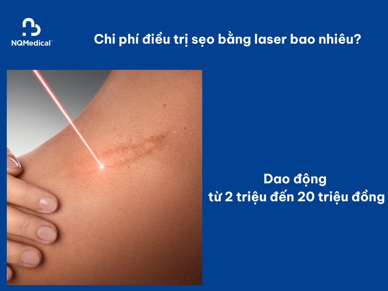 Trị sẹo bằng laser - 8