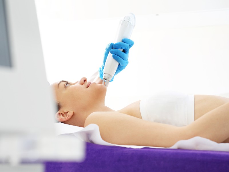 trị sẹo lồi bằng laser giá bao nhiêu - 5