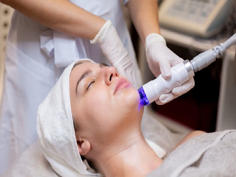 trị sẹo mụn bằng laser - 11