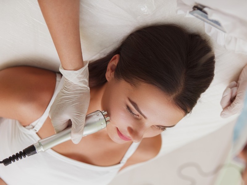 trị sẹo mụn bằng laser - 2