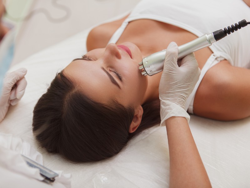 trị sẹo rỗ bằng laser - 3