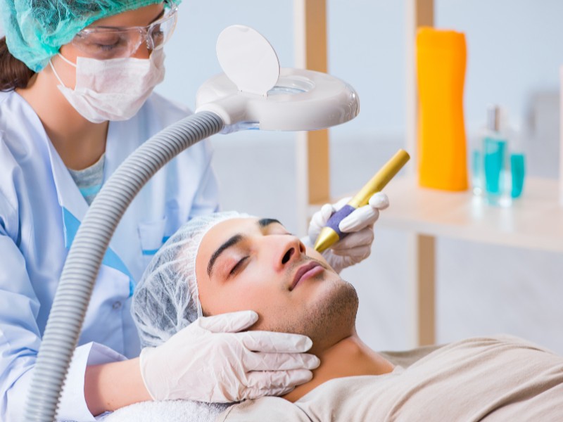 trị sẹo rỗ bằng laser - 8