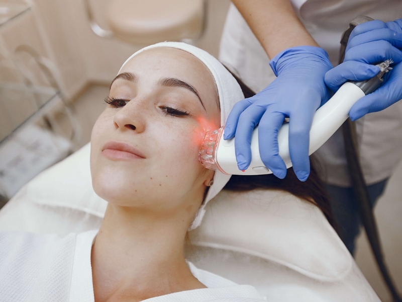 Trị tàn nhang bằng laser - 3