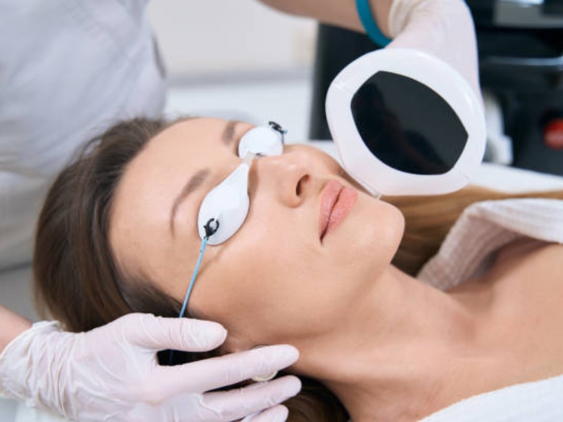 Trị tàn nhang bằng laser có hết không - 5
