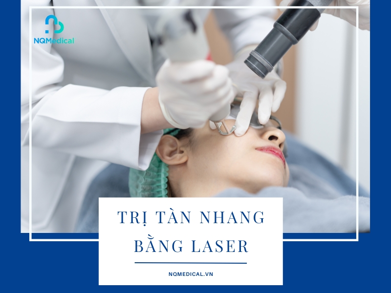 Trị tàn nhang bằng laser