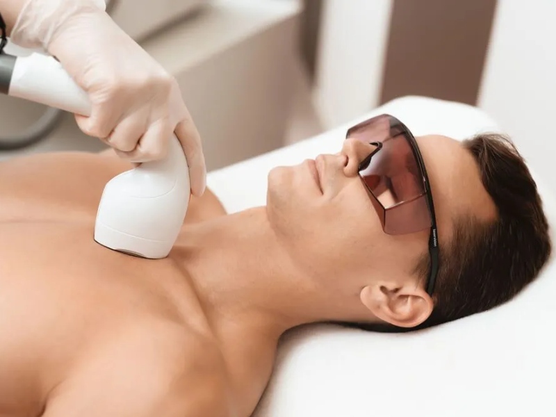 Xóa bớt bằng laser - 6