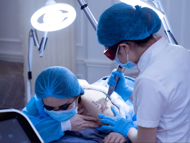 xóa xăm bằng laser bao nhiêu lần thì hết - 4 xóa xăm bằng laser bao nhiêu lần thì hết - 4