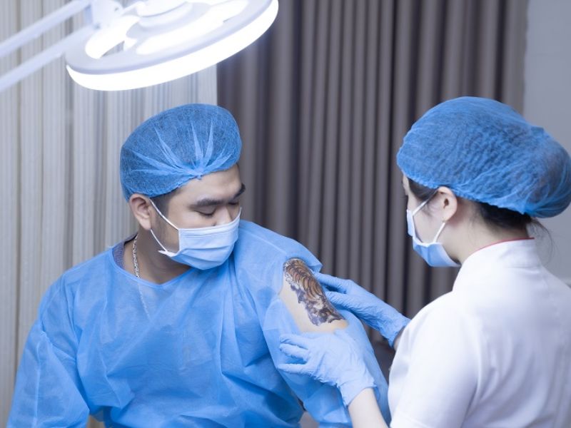 Xóa hình xăm bằng laser giá bao nhiêu - 4 Xóa hình xăm bằng laser giá bao nhiêu - 4