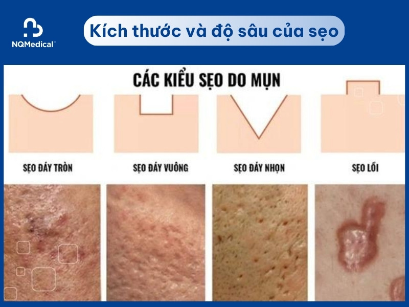 xóa sẹo bằng laser bao nhiêu tiền - 3
