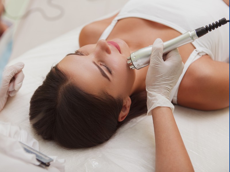 xóa sẹo lõm bằng laser - 2