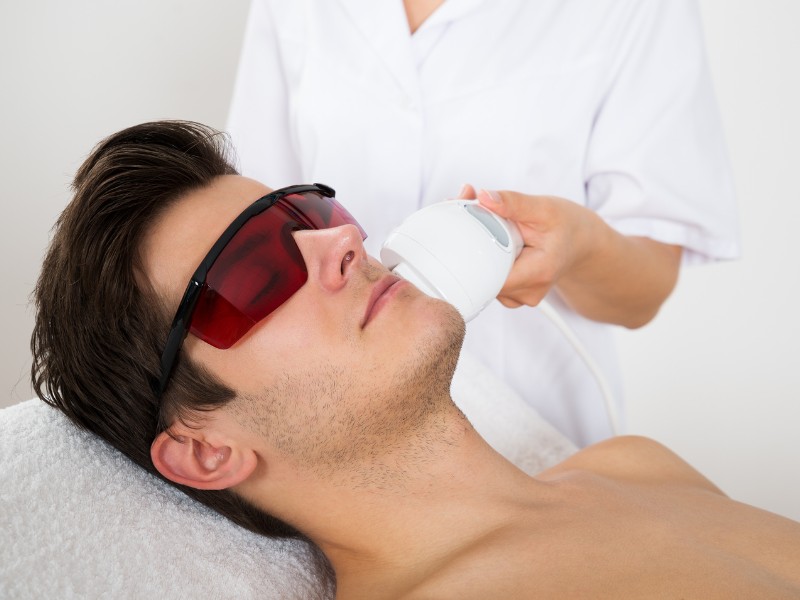 xóa sẹo lõm bằng laser - 6