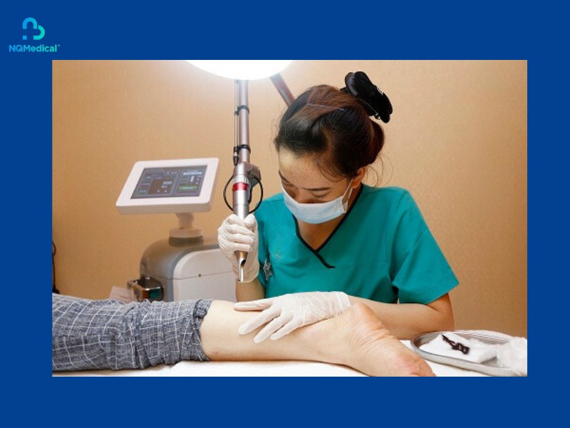 xóa sẹo phỏng bô bằng laser-3