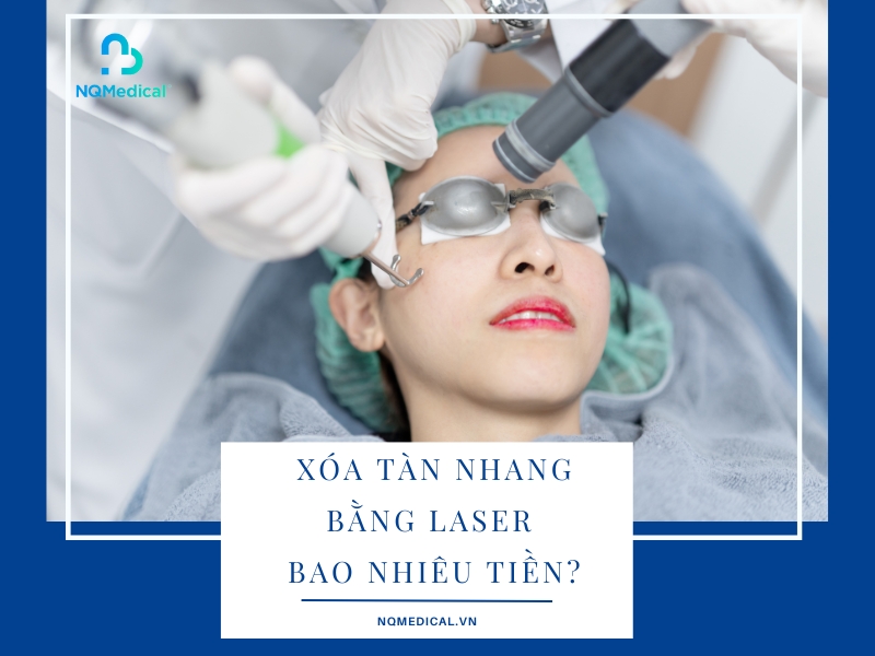 Xóa tàn nhang bằng Laser bao nhiêu tiền
