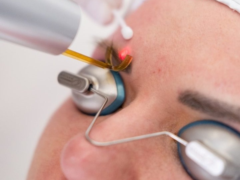 Xóa xăm chân mày bằng laser - 6