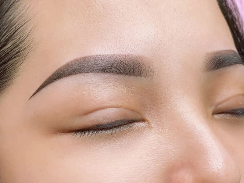 Xóa xăm lông mày bằng laser giá bao nhiêu - 2