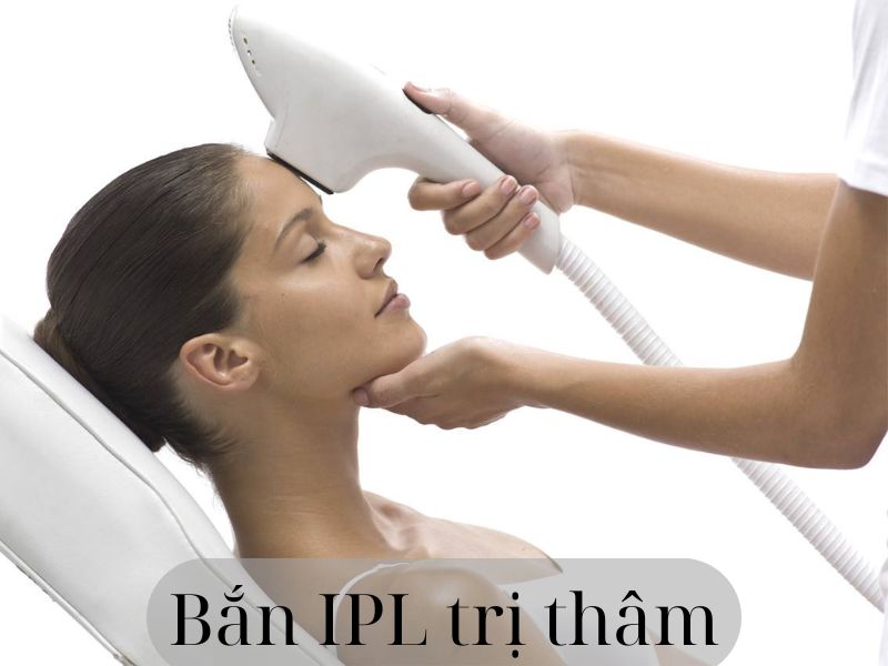 Bắn IPL trị thâm - 1
