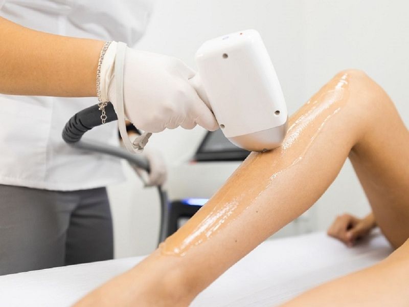 Bắn IPL trị thâm - 11