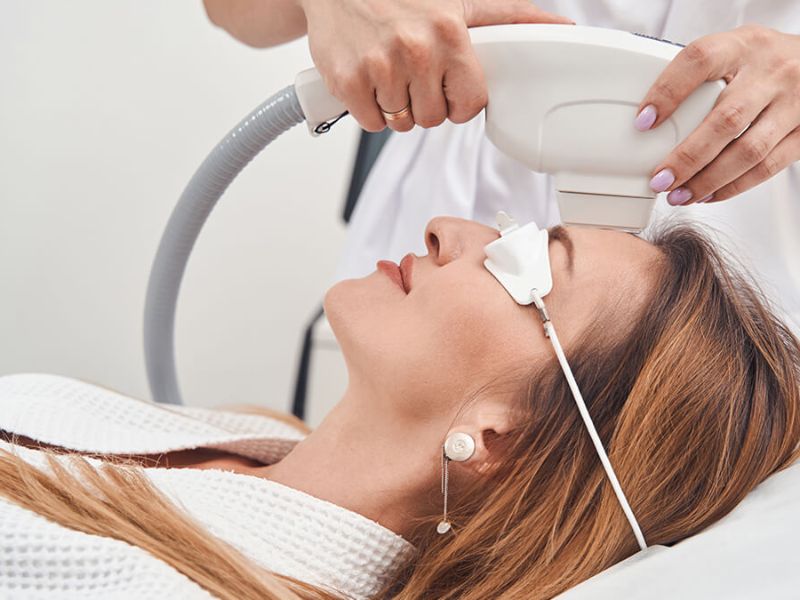 Bắn IPL trị thâm - 2