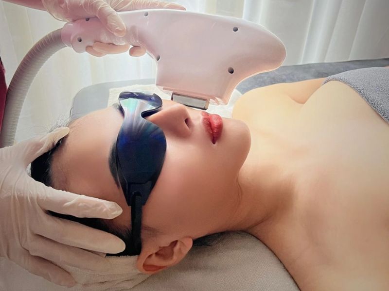 Bắn IPL trị thâm - 7