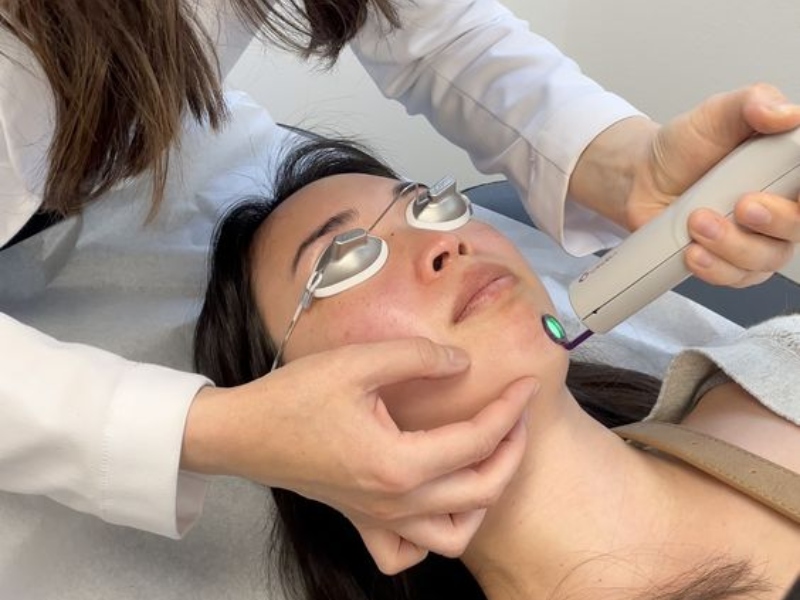 Bắn laser bao lâu thì hết thâm - 2