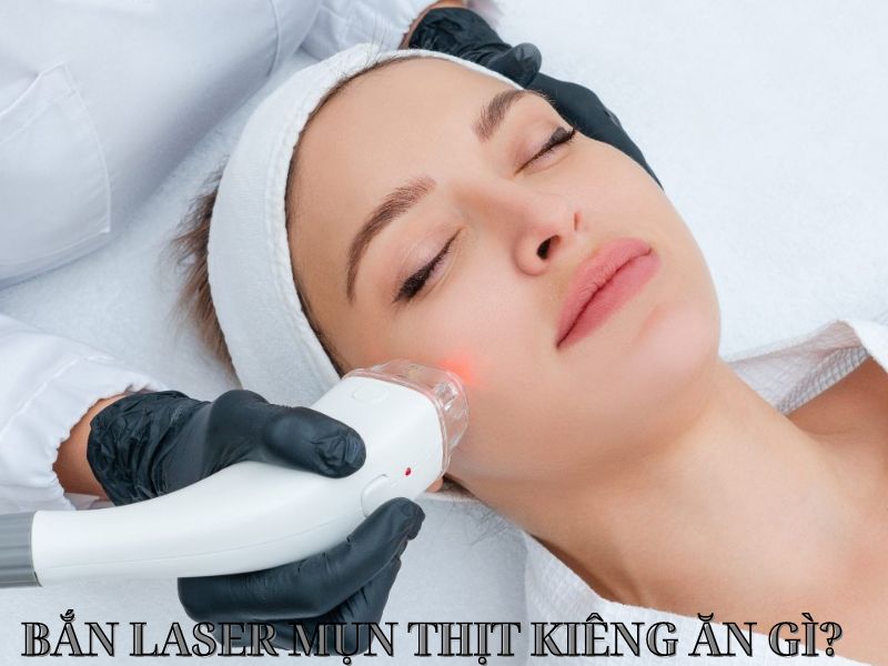 bắn laser mụn thịt kiêng ăn gì - 1