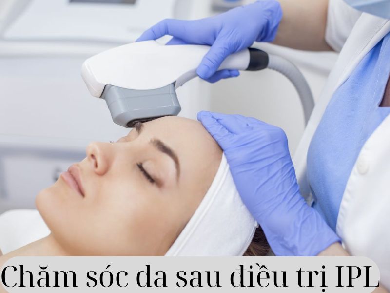 Chăm sóc da sau điều trị IPL - 1