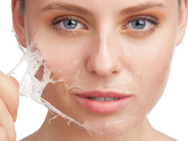 Chăm sóc da sau điều trị IPL - 5