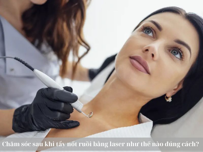 Chăm sóc sau khi tẩy nốt ruồi bằng laser -1