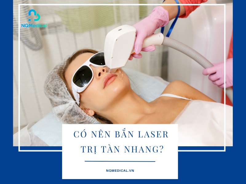 Có nên bắn laser trị tàn nhang