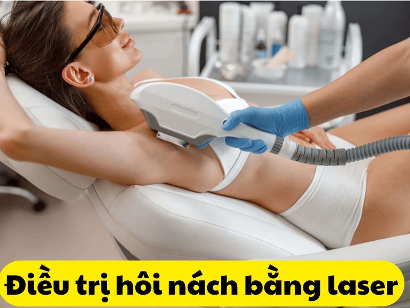 Điều trị hôi nách bằng laser - 1