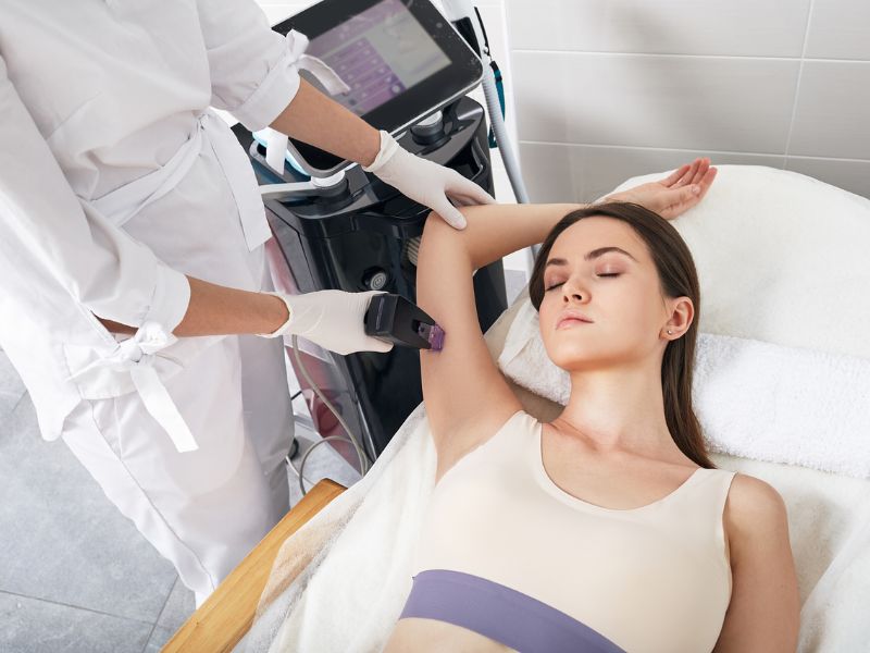 Điều trị hôi nách bằng laser -9